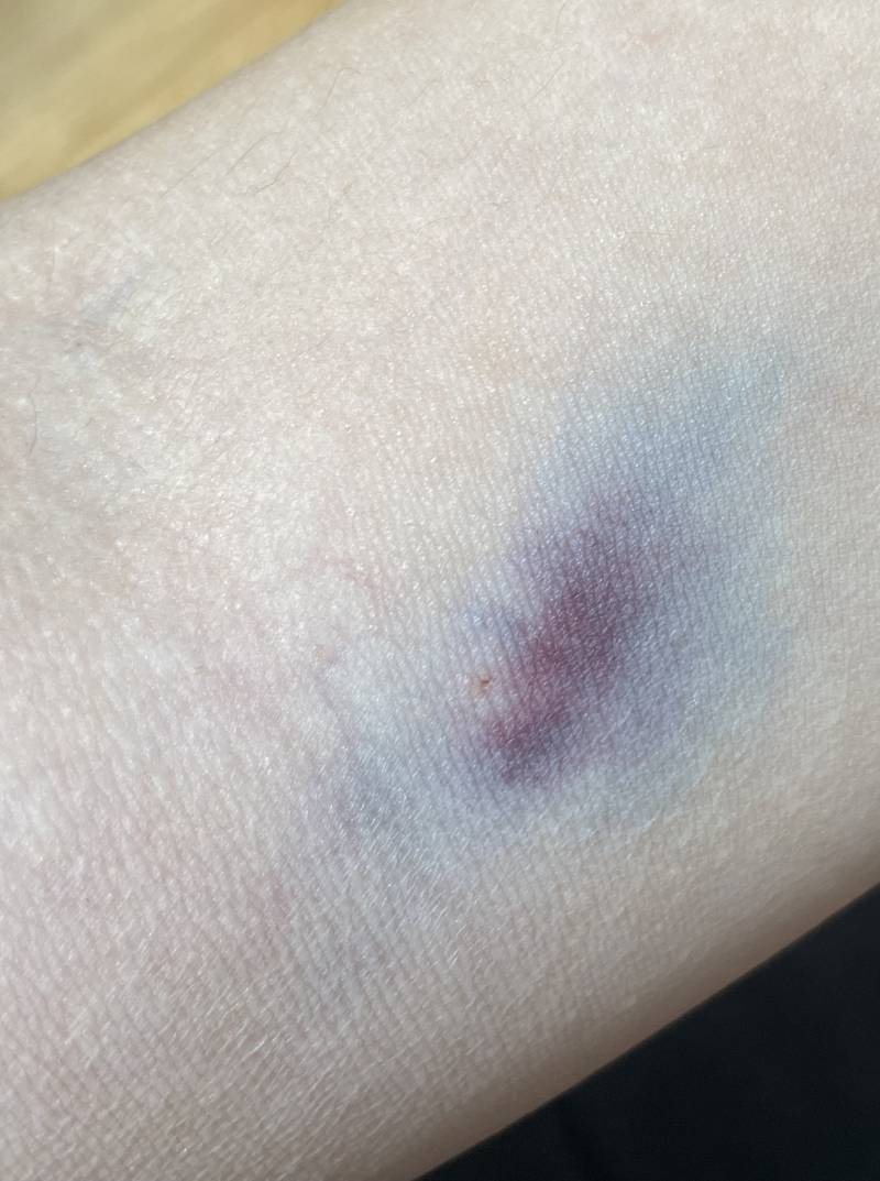 간호사 익들아 이거 괜찮은거야...? | 인스티즈