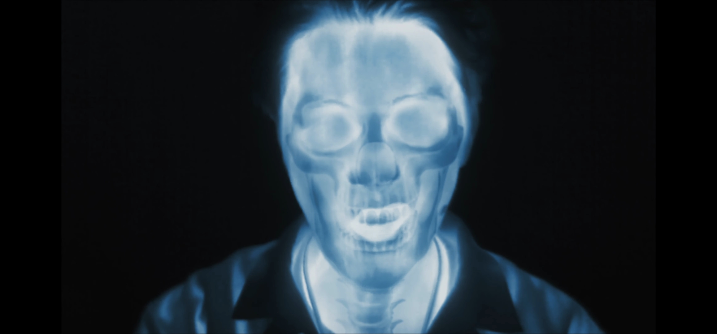 [잡담] 데뷔 10년차에 뼈 사진까지 공개하는 아이돌 어떰 | 인스티즈