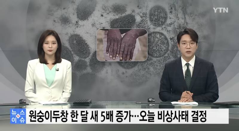 결국 원숭이 두창도 판데믹 ㅋㅋ | 인스티즈