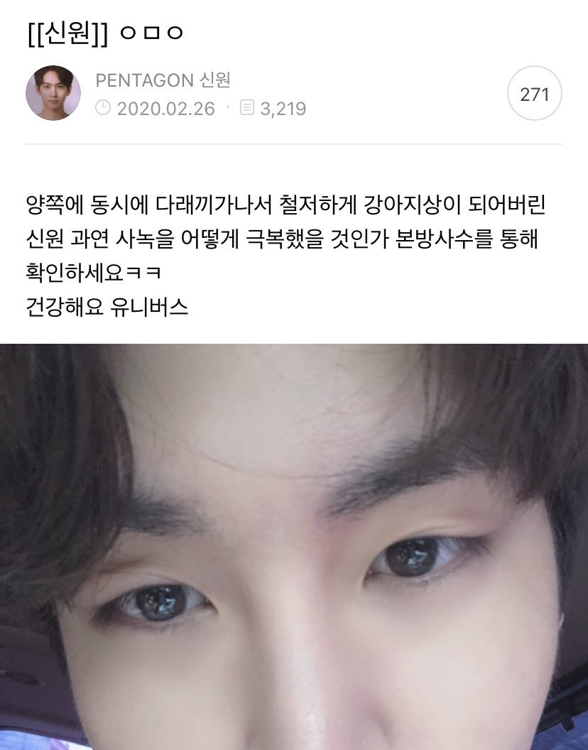 [잡담] 신원이 다래끼 매년 나는거같애ㅠㅠㅋㅋㅋㅋ | 인스티즈