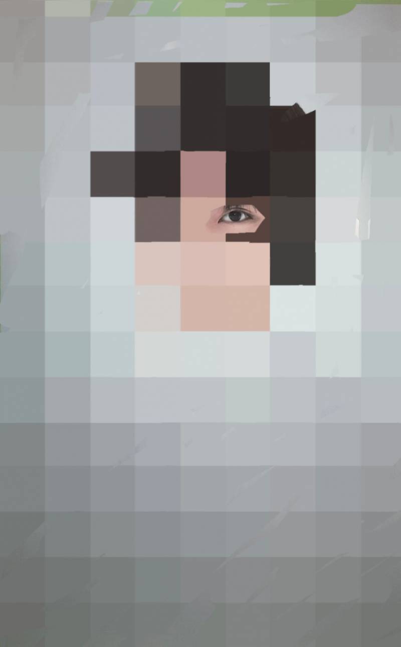 크리즈랑 쌍커풀이랑 어떻게 구분해?? | 인스티즈