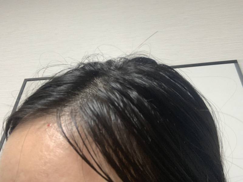 🚫ㅎㅇㅈㅇ 더러움 주의🚫 이정도 떡졌는데 염색해도 되나?? | 인스티즈