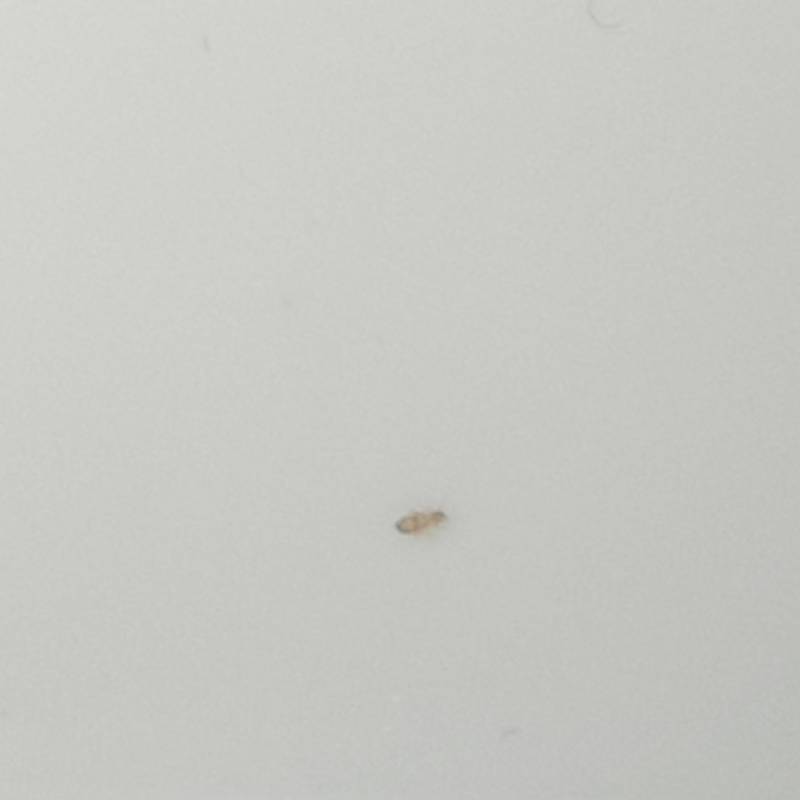 자취익인데 이런 흰색?벌레가 계속나와ㅜㅜ(사진O) | 인스티즈