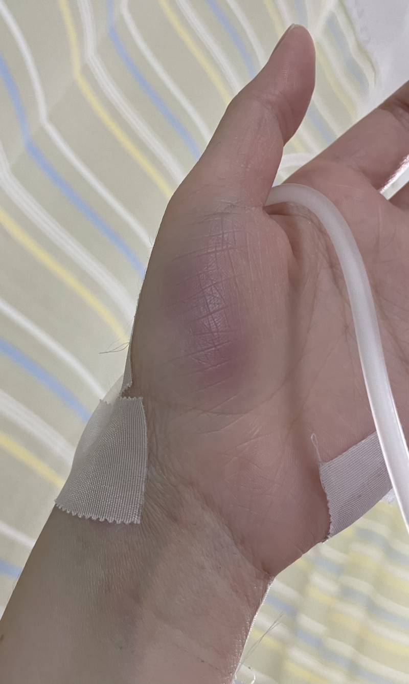 간호사익 있어? | 인스티즈