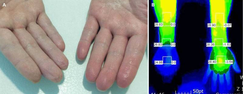 물에 오래 있으면 손 끝 쭈글쭈글해지는 이유 생각하고 들어와봐 | 인스티즈