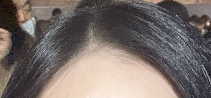 여익들아 머리 뽕 도대체 어찌 살려ㅠㅠㅠ 나 아예 안하고 트린트먼트까지 했더니 이렇게 됨… | 인스티즈