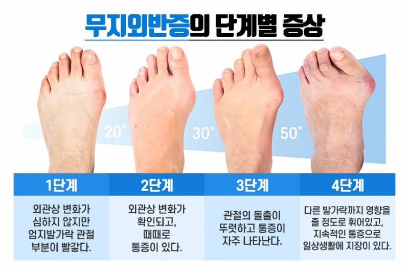 여자들한테 은근 흔하다는 거 | 인스티즈