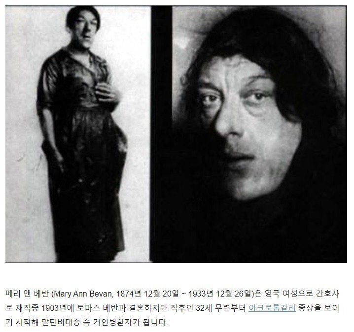 가장 못생긴 여자 콘테스트 | 인스티즈