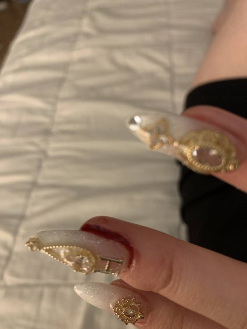 익들아 나 문틈에 손끼어서 손톱에서 피나는데 어떻게 해야돼? | 인스티즈