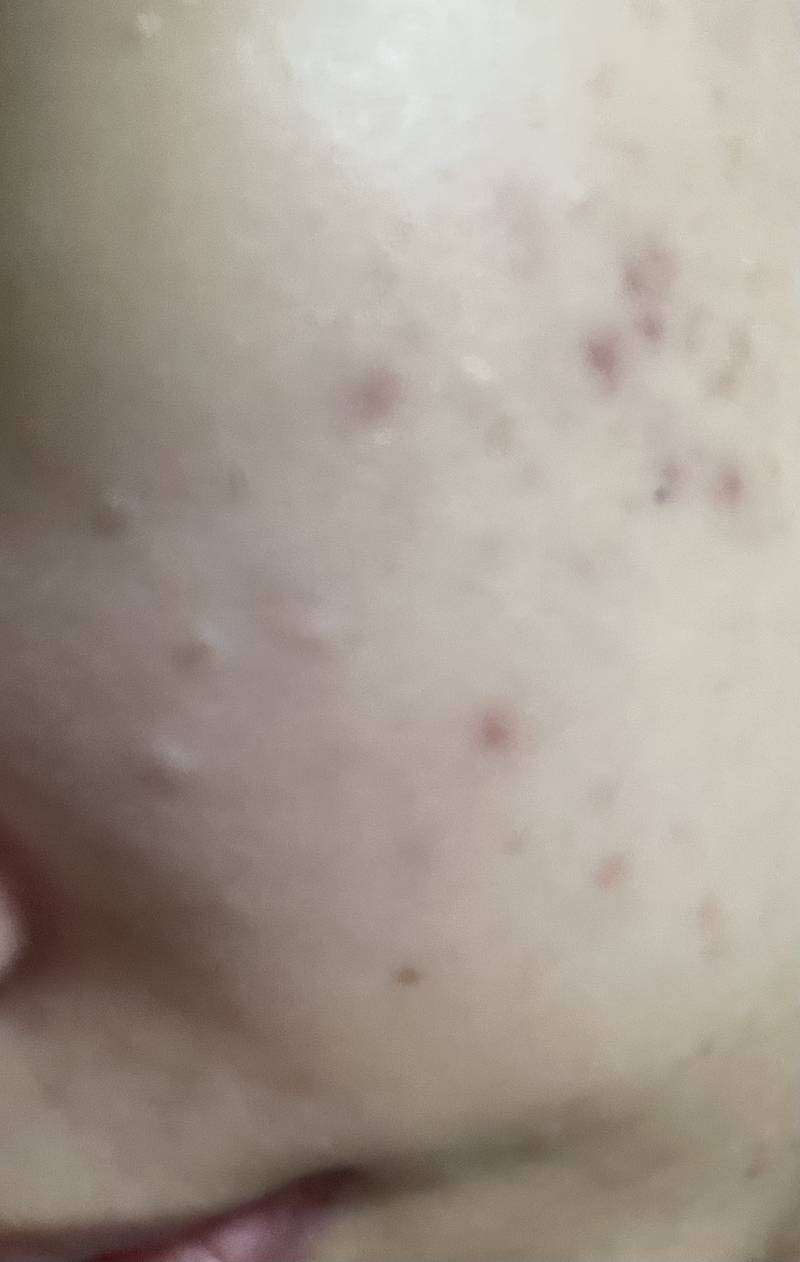 피부 진짜 좋아지고 싶은데 조언해줄수 있어? ㅎㅇㅈㅇ | 인스티즈