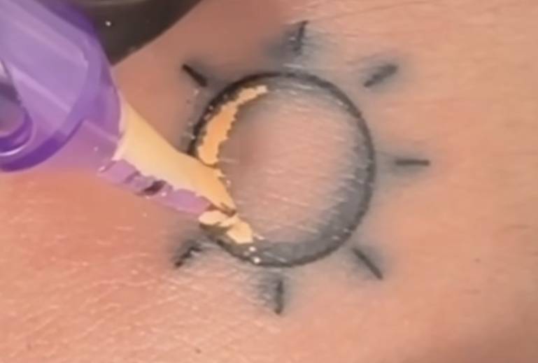 리터치타투 이렇게 하는거 효과 있어...? | 인스티즈