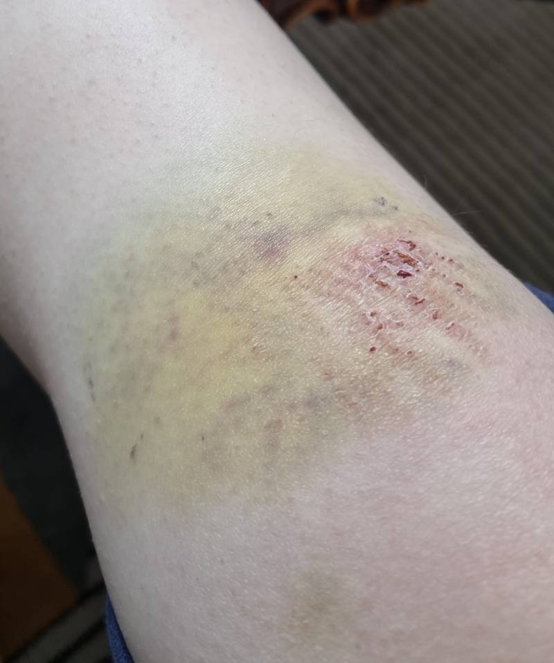 술먹고 자빠지면 생기는일 | 인스티즈