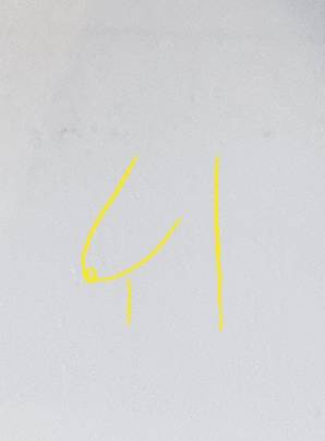 나 가슴 ㄹㅇ이런데 이거 우짜니..ㅠㅠ | 인스티즈