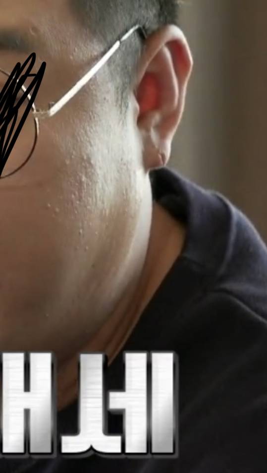 와 나 심각하게 요요 오고있는데 귀 옆에도 살찌고있어 | 인스티즈