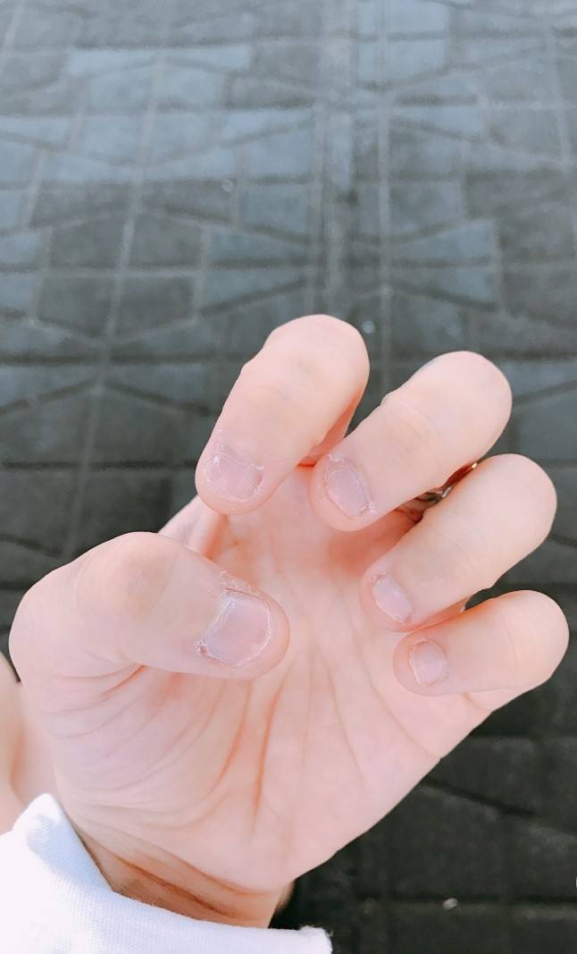 [잡담] 양손 손톱이 짝짝이인거 이상해...? | 인스티즈