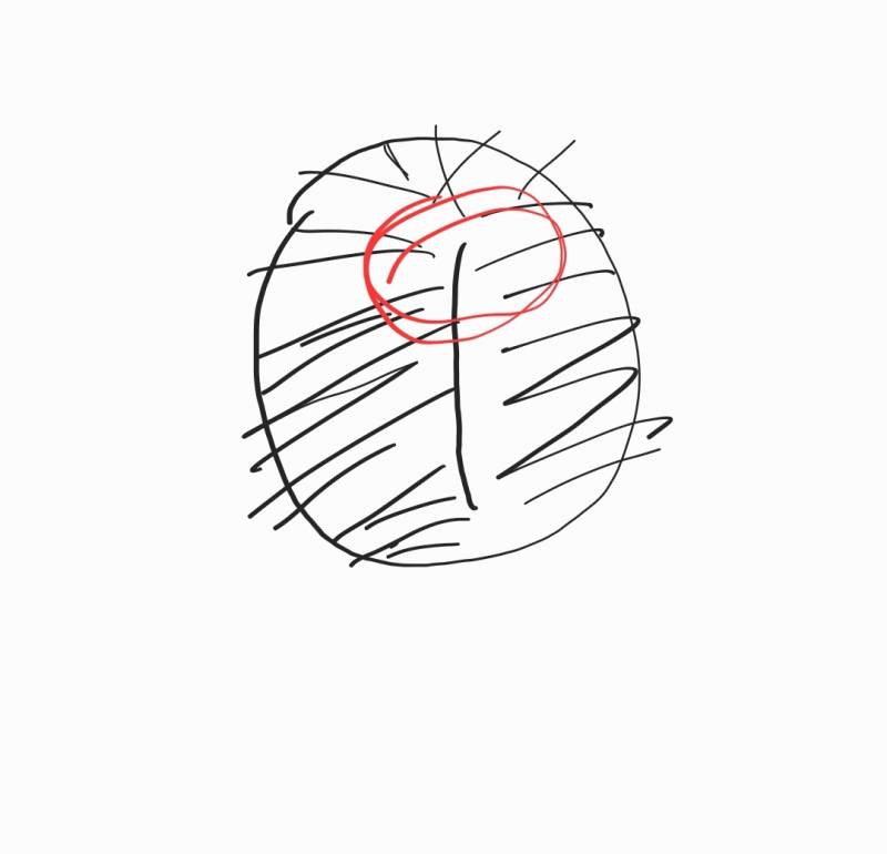 나처럼 두피 아픈익들 있니?? | 인스티즈