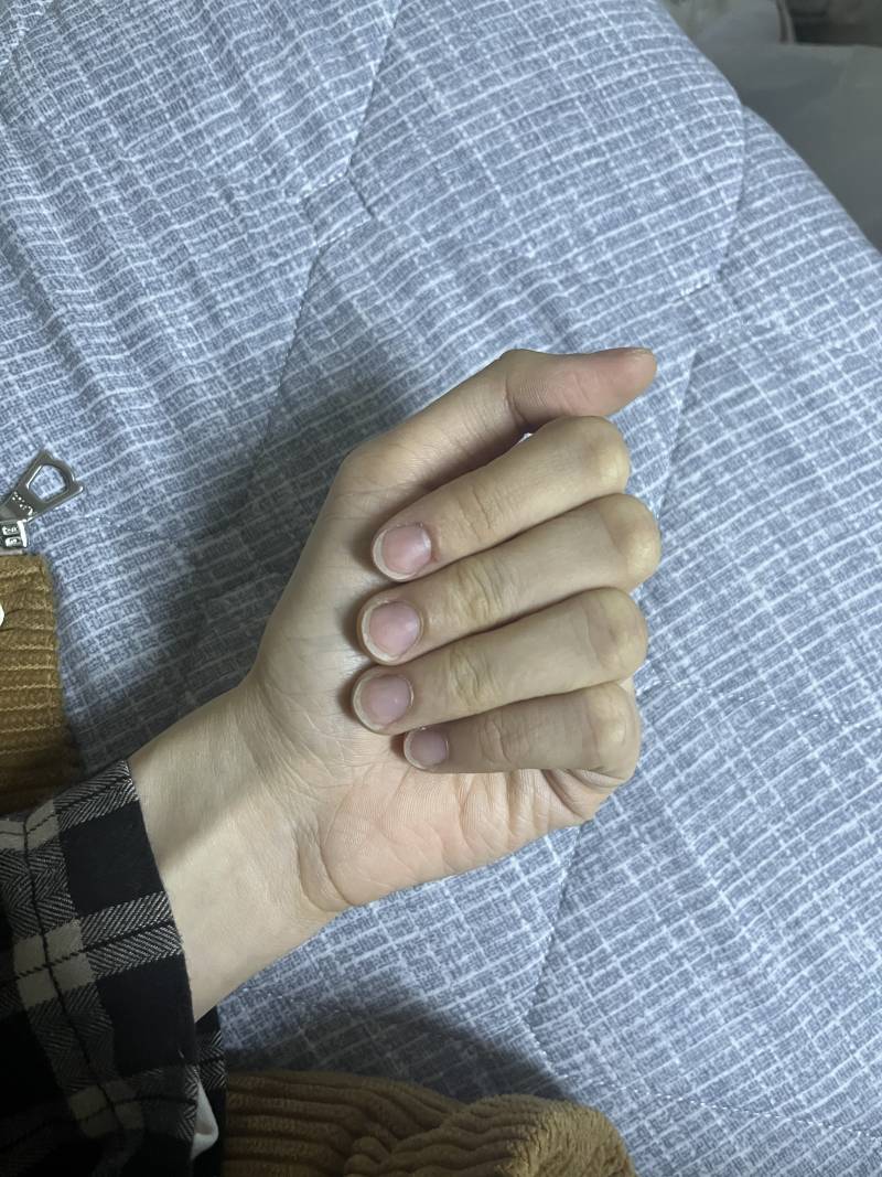 손톱 지금 이난리인데 몇 주 더 기르고 가야할까 ??? 네일 박사들 있니 … | 인스티즈
