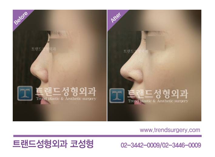 얘들아 이런 코 좋아하면 미감 ㅂㄹ임?? | 인스티즈