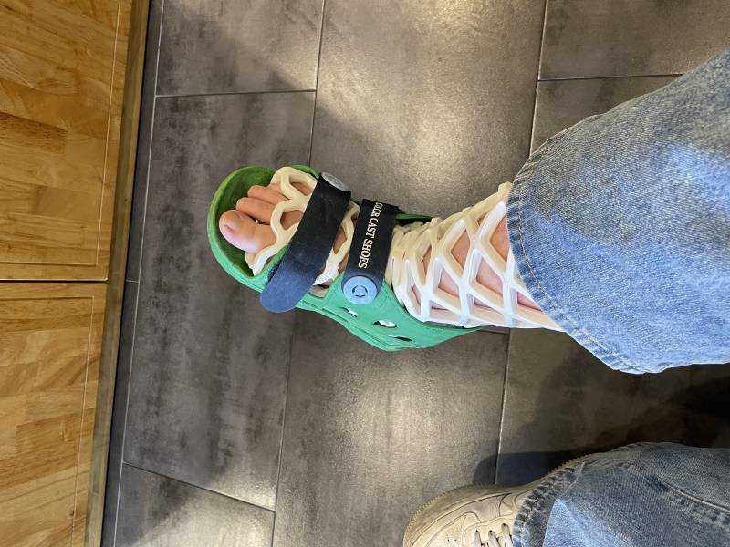 2022년의 마지막을 깁스로 마무리하는 나 멋져 | 인스티즈