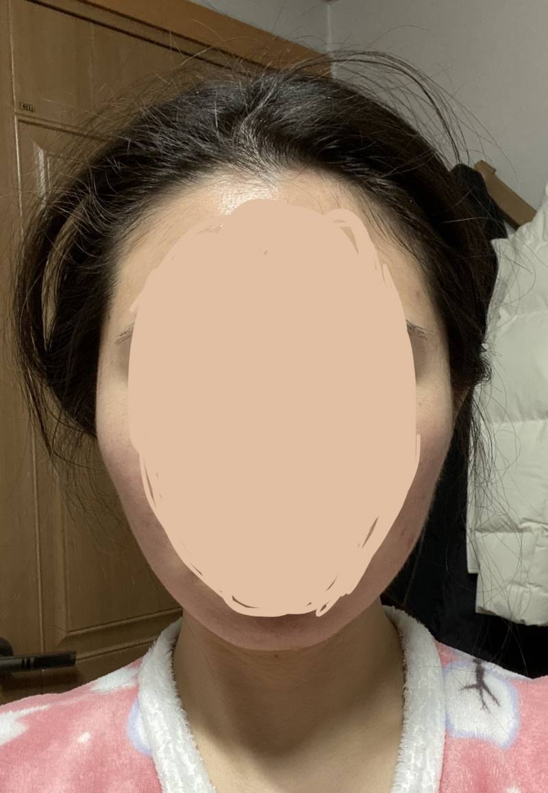 얼굴형 변화있는것같아...? | 인스티즈