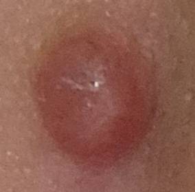 이 점 그대로 놔두면 알아서 빠지려나? | 인스티즈