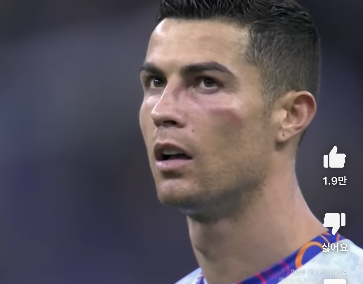 [잡담] 헐 호날두 얼굴 많이 부었다 | 인스티즈