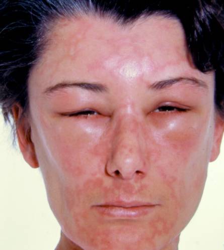 응급실 가야하나 말아야하나 한번만 봐주라.. (사진주의)ㅎㅇㅈㅇ | 인스티즈