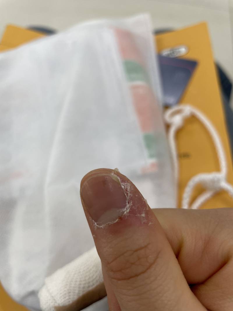 이거 손톱 관리 어케 해야돼ㅠㅠㅠ? | 인스티즈