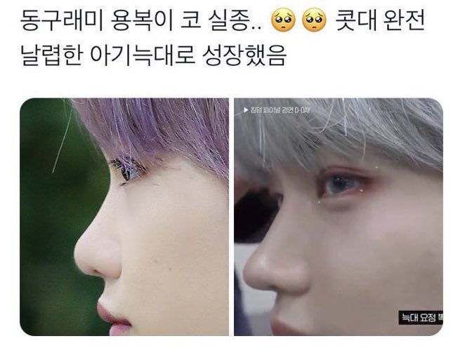 [마플] 아니 어떻게하면 필릭스처럼 코 변하는거지 | 인스티즈