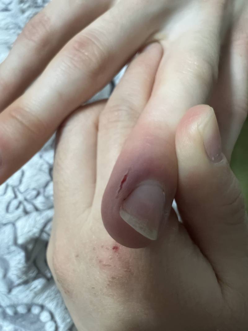 고양이가 할퀴었는데 괜찮나? | 인스티즈