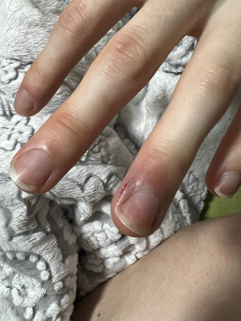 고양이가 할퀴었는데 괜찮나? | 인스티즈