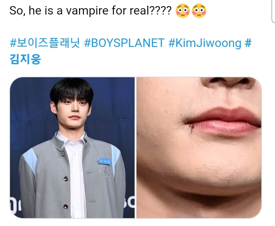 [잡담] 지웅이 입술상처난거 속상해하고있었는데 | 인스티즈