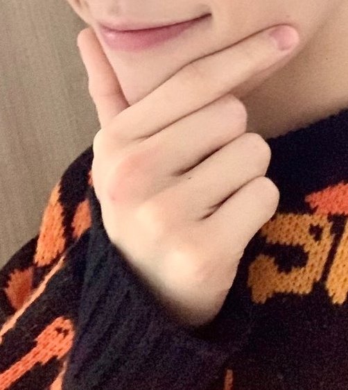 [잡담] 태래 손등 상처?흉터? 과거사진에도 있네 | 인스티즈