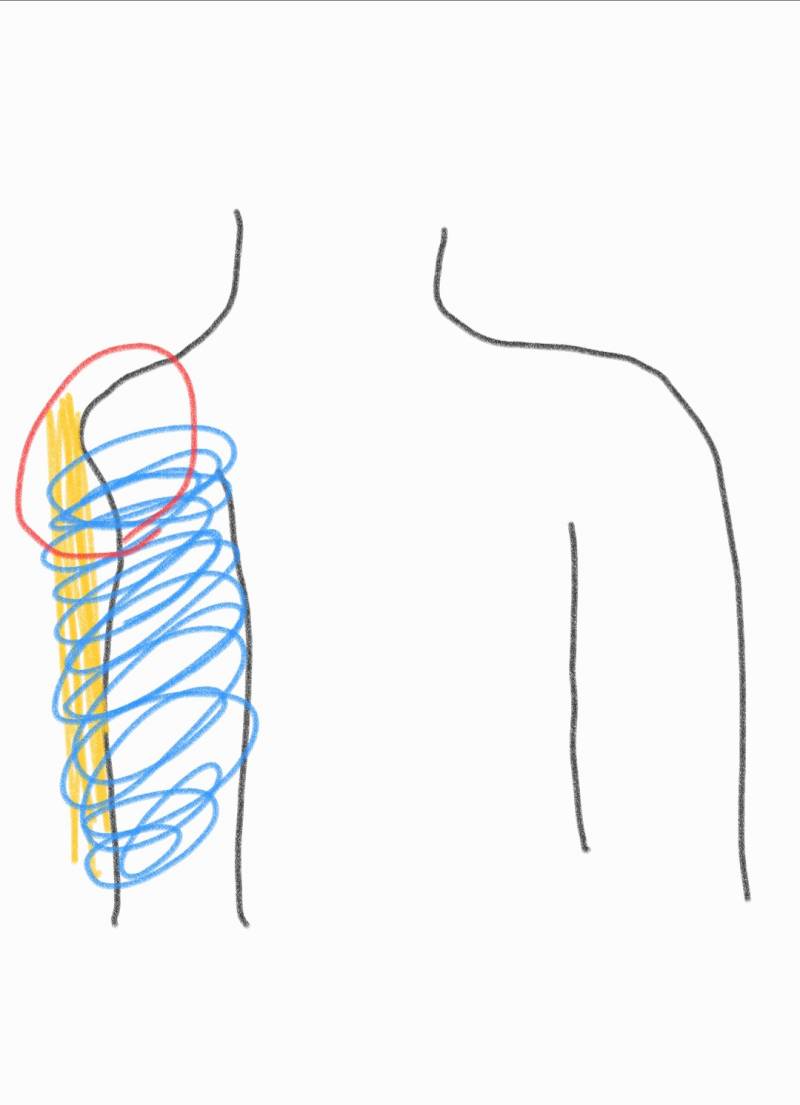 바쁠텐데 미안하지만 응급처치 제대로 한 건지 한 번만 봐줄 수 있어? | 인스티즈