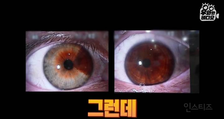 오드아이를 가진 한국인 (세상에 이런일이) | 인스티즈