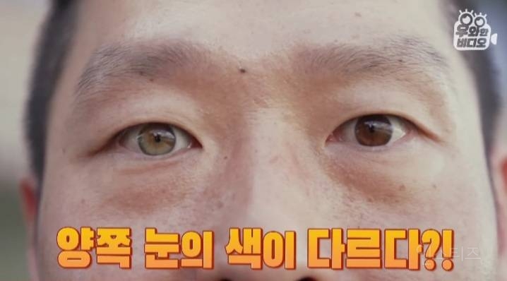 오드아이를 가진 한국인 (세상에 이런일이) | 인스티즈