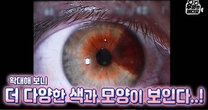 오드아이를 가진 한국인 (세상에 이런일이) | 인스티즈