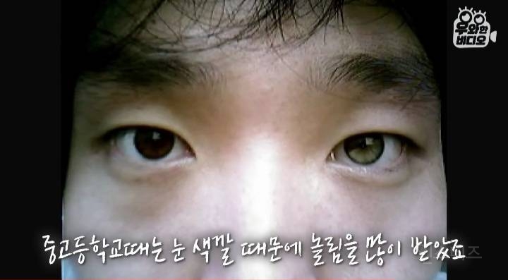 오드아이를 가진 한국인 (세상에 이런일이) | 인스티즈