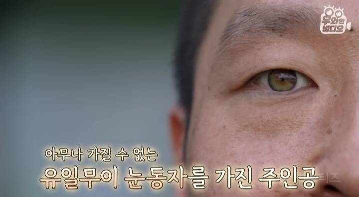 오드아이를 가진 한국인 (세상에 이런일이) | 인스티즈