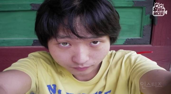 오드아이를 가진 한국인 (세상에 이런일이) | 인스티즈