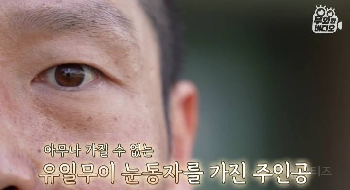 오드아이를 가진 한국인 (세상에 이런일이) | 인스티즈