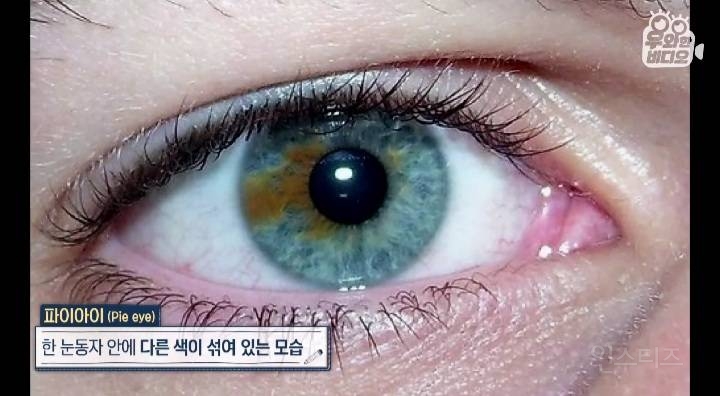 오드아이를 가진 한국인 (세상에 이런일이) | 인스티즈