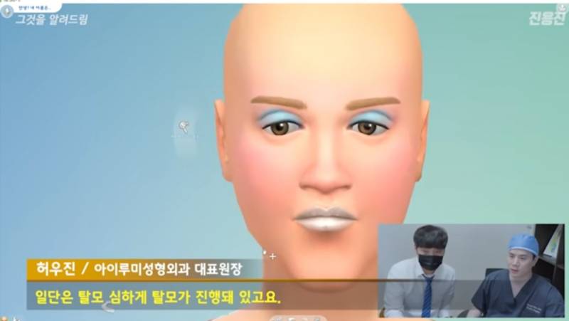 성형외과 원장이 게임캐릭터 얼굴 성형 해보면? | 인스티즈