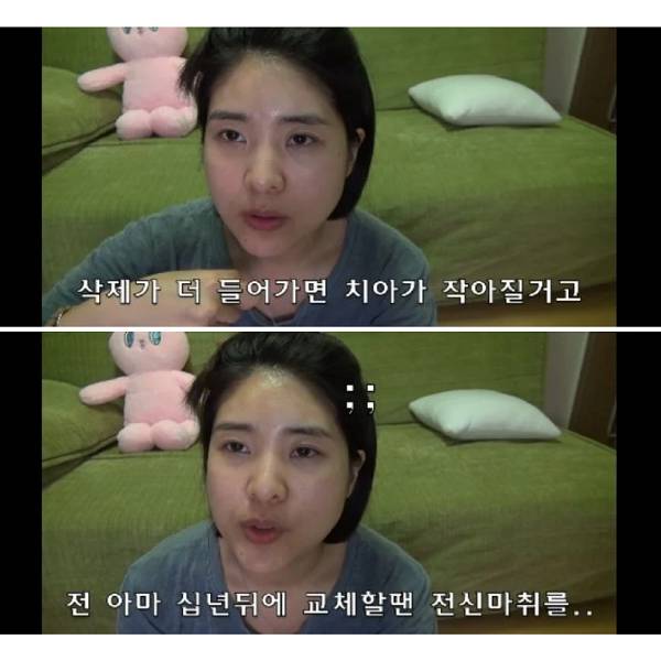 연예인들은 필수인데 부작용 너무 많은 시술..jpg | 인스티즈