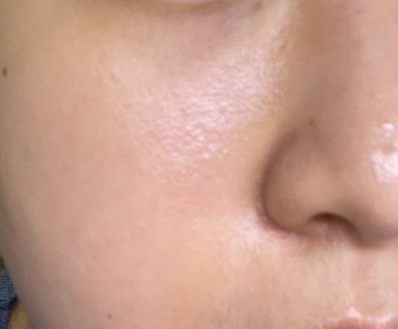 [잡담] ㅎㅇㅈㅇ 이정도가 피부 좋은거야? | 인스티즈