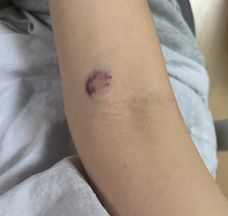 [잡담] 간호익 있어??ㅠㅠ | 인스티즈