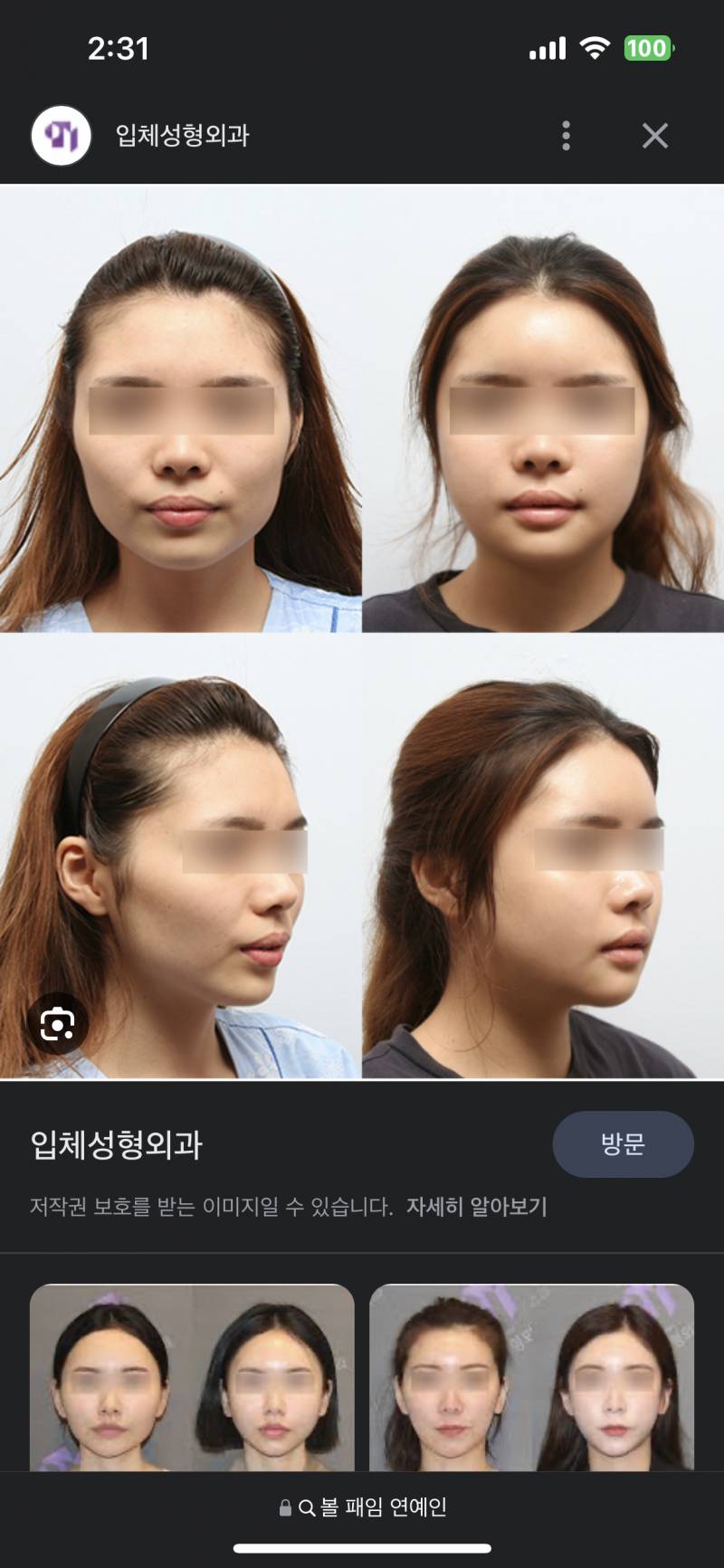 [잡담] 익들이 왼쪽 얼굴이라면 윤곽 할거임?? - 인스티즈(instiz) 일상 카테고리