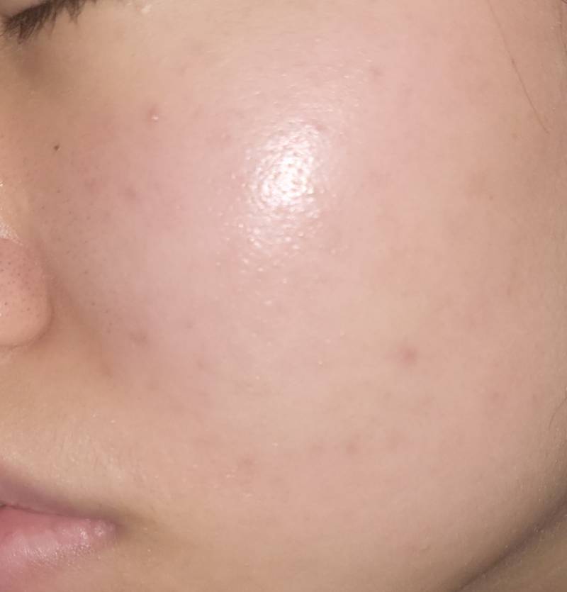 [잡담] 나 피부 많이 좋아진듯 | 인스티즈