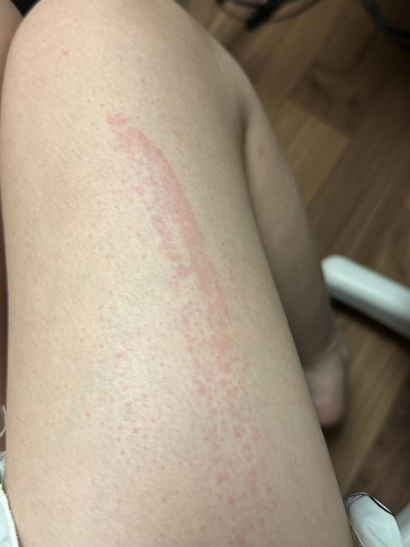 [잡담] 와 아침에 면도기로 제모했는데 (ㅎㅇㅈㅇ) | 인스티즈