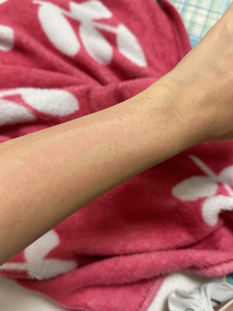 [잡담] 와 아침에 면도기로 제모했는데 (ㅎㅇㅈㅇ) | 인스티즈